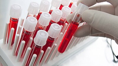 Bilim insanları yapay kan üretti!