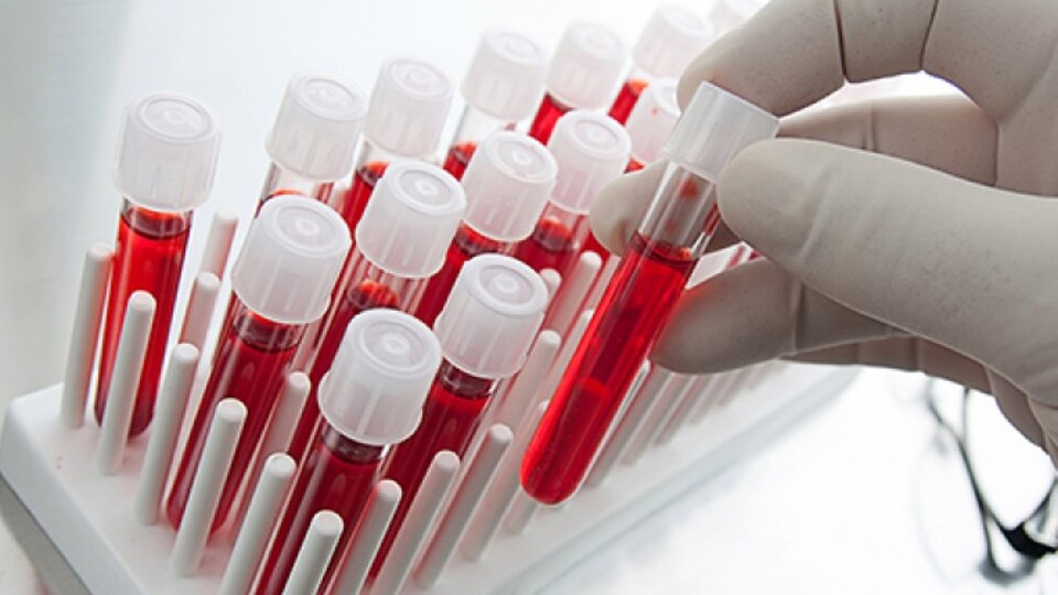 Bilim insanları yapay kan üretti!