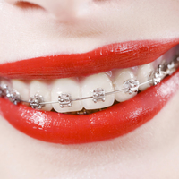 Mükemmel dişler sizi bekliyor!