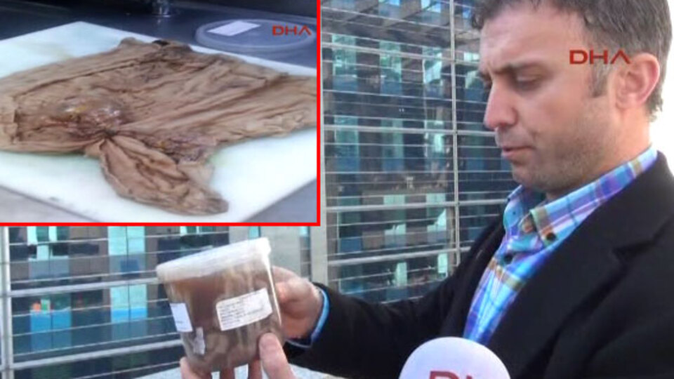 Hastanede skandal! Karnında unuttular!