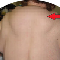 Alkol tüketimi onu bu hale getirdi!