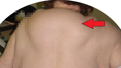 Alkol tüketimi onu bu hale getirdi!