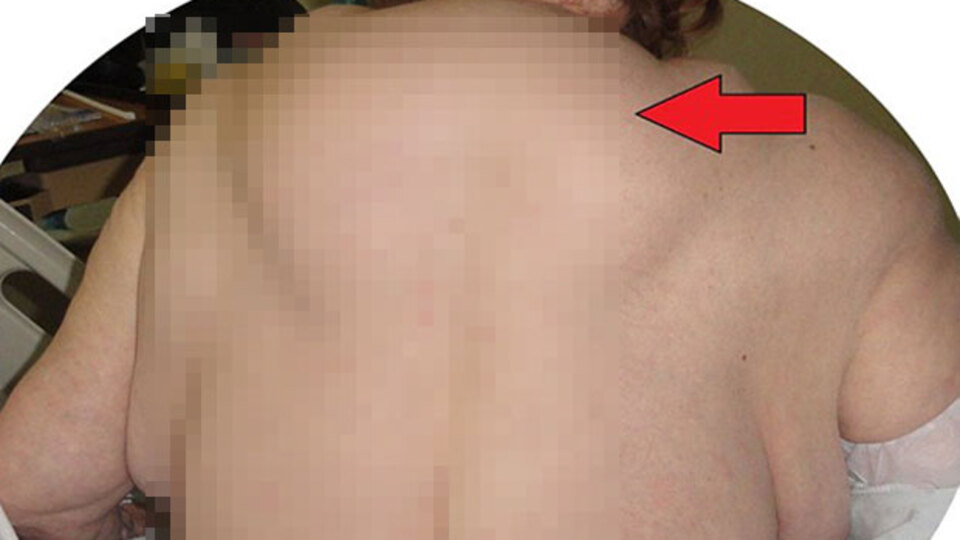 Alkol tüketimi onu bu hale getirdi!