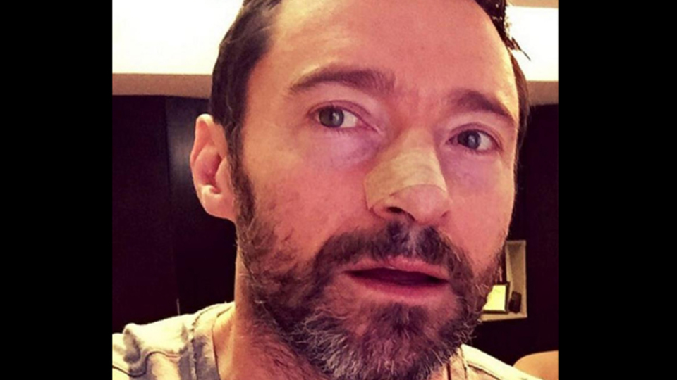 Ünlü oyuncu kanserle mücadele ediyor