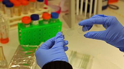 Zika aşısı ne zaman çıkacak?