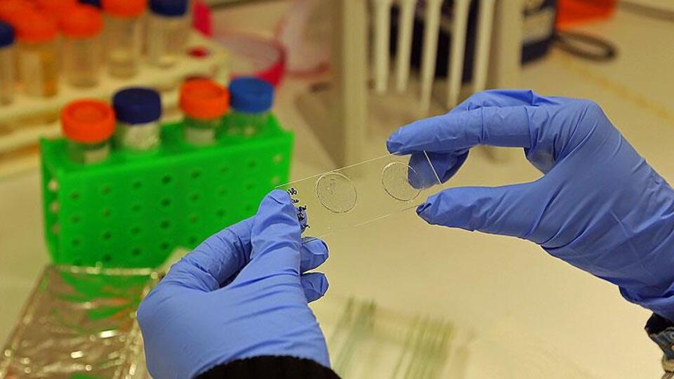 Zika aşısı ne zaman çıkacak?