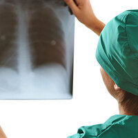 Sigara içen akciğer kanserli hastaların ilaç parası ödenmeyecek mi?