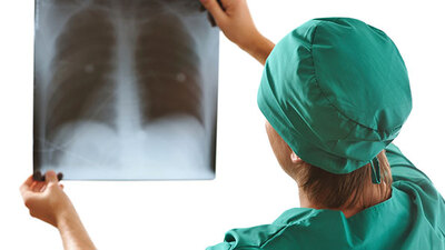 Sigara içen akciğer kanserli hastaların ilaç parası ödenmeyecek mi?