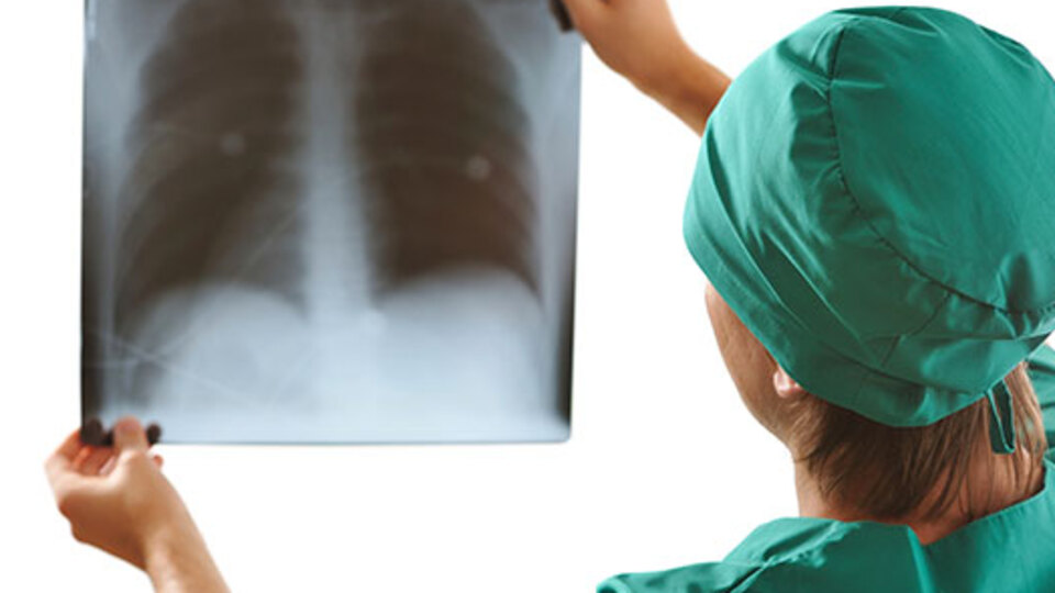 Sigara içen akciğer kanserli hastaların ilaç parası ödenmeyecek mi?