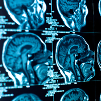 Dikkat beyni küçültüyor!