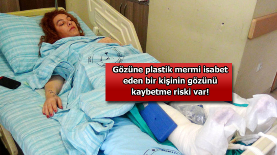 Cerattepe'de yaralananlar o anları anlattı