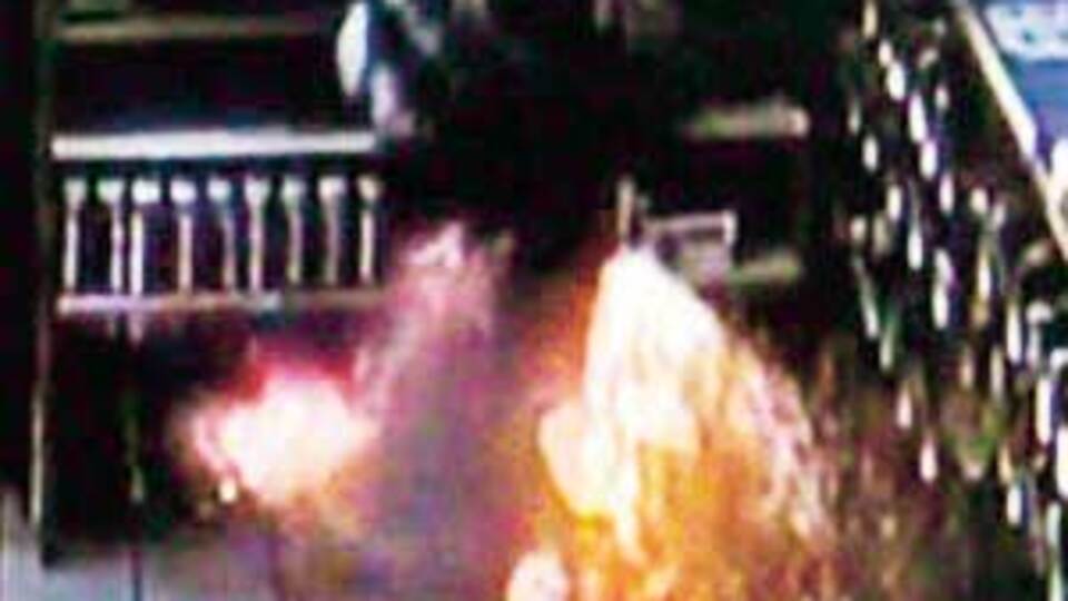 Sigarası cebinde patladı!