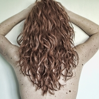 Vücudunuzdaki benleri sayın! Eğer 50'den fazla varsa...