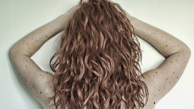 Vücudunuzdaki benleri sayın! Eğer 50'den fazla varsa...