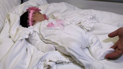 Bu hastalığı daha önce duymadınız...