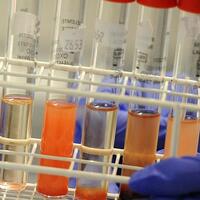 Kanser tedavisinde yeni gelişmeler!