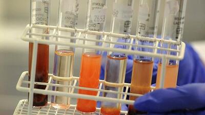 Kanser tedavisinde yeni gelişmeler!