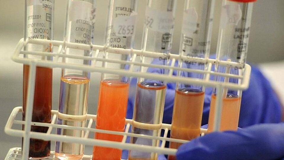 Kanser tedavisinde yeni gelişmeler!