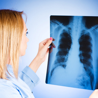 Kanser 10 yıl sonra etkisiz mi olacak?