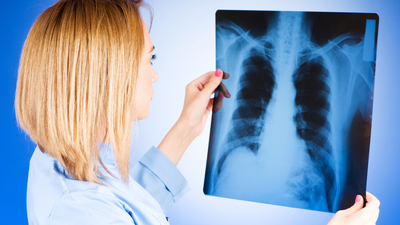 Kanser 10 yıl sonra etkisiz mi olacak?