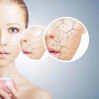 Gözeneklerden kurtulma rehberi!