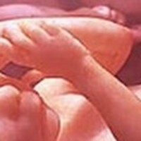 İkizini yiyen bebek efsanesi doğru mu?