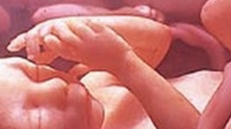 İkizini yiyen bebek efsanesi doğru mu?