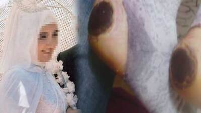 Doğumdan sonra bu hale geldi!