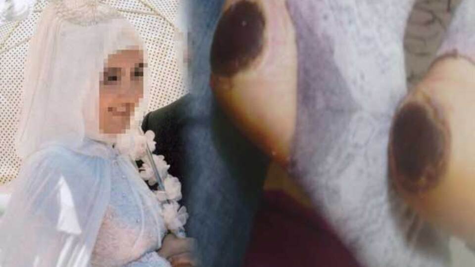 Doğumdan sonra bu hale geldi!