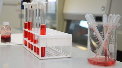 HIV virüsü DNA'dan ayıklandı!