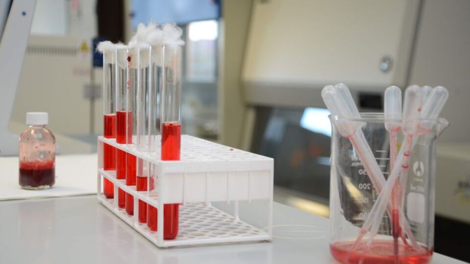 HIV virüsü DNA'dan ayıklandı!