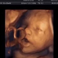 Anne karnındaki bebeğe müzik dinletilirse...