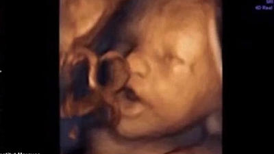 Anne karnındaki bebeğe müzik dinletilirse...