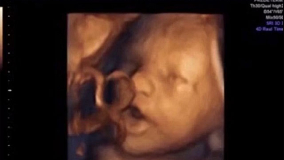 Anne karnındaki bebeğe müzik dinletilirse...