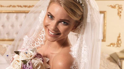 Düğün hazırlığına estetik eklendi!