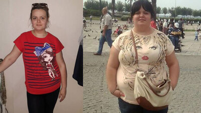 Şeker hastalığından korunmak için bunu yaptı!