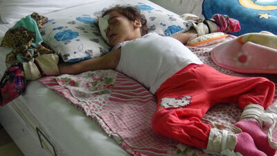 Dişlerini söküyor, burnunu parçalıyordu... Minik Selen'den acı haber geldi!