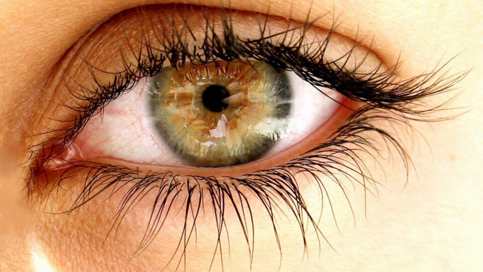 Dikkat göz kanserleri belirti vermeyebiliyor!