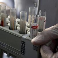 Hepatit B tarihe karışacak!