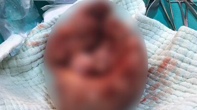 Rahminden bebekten büyük kitle çıkarıldı!