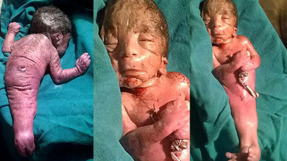 Hindistan'da deniz kızı doğdu!