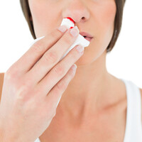 Burun kanaması nasıl durdurulur?