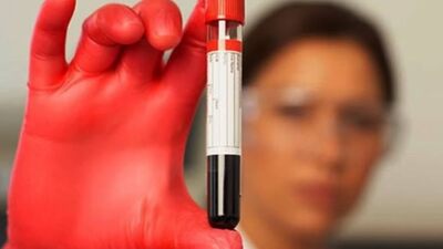 Talasemi tedavi edilebiliyor ama...