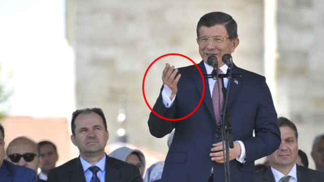 Davutoğlu'nun elindeki bandajın sırrı belli oldu