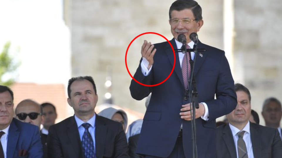 Davutoğlu'nun elindeki bandajın sırrı belli oldu