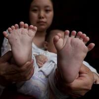 Bu ailenin parmak sayısı görenleri şaşırtıyor!