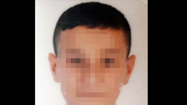Kokladığı çakmak gazı sonu oldu