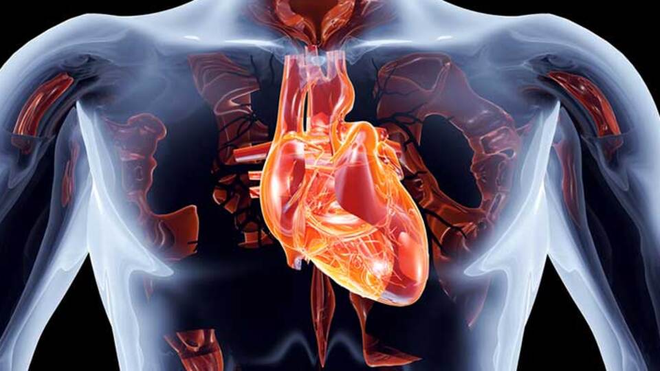 Aort damarı neden ve nasıl yırtılır?