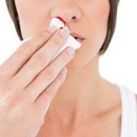 Burnu kanayan birine sakın bunu yapmayın!