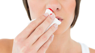 Burnu kanayan birine sakın bunu yapmayın!